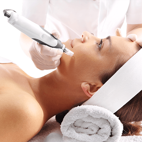 Microneedling